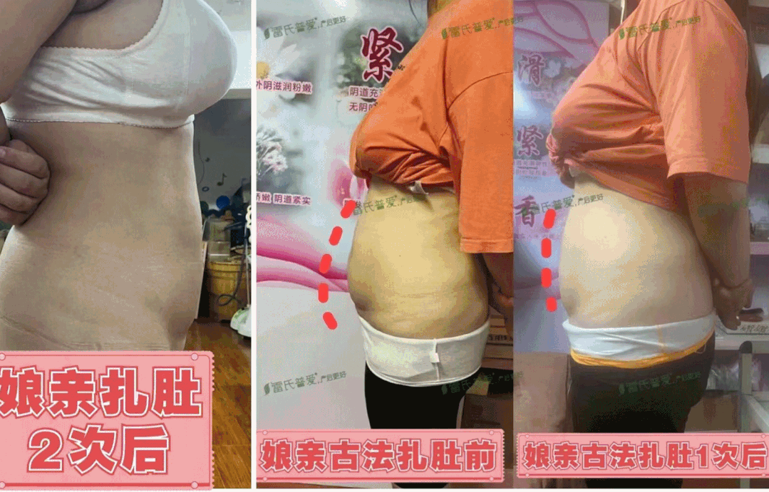 娘亲古法扎肚效果前后对比